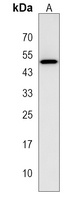 Anti-UBXN6 Antibody