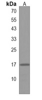 Anti-GLRX5 Antibody