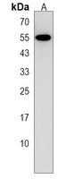 Anti-POTEH Antibody