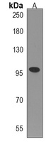 Anti-TTI1 Antibody