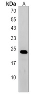 Anti-PTPLB Antibody