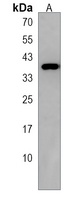 Anti-MFAP4 Antibody