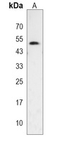 Anti-GSDMA Antibody