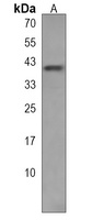 Anti-KLHDC2 Antibody