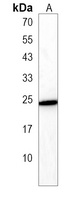 Anti-C16orf54 Antibody