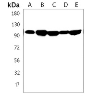 Anti-ANKFY1 Antibody