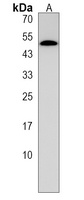 Anti-PRAK (Phospho-S93) Antibody