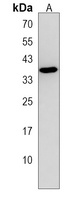 Anti-AIMP2 Antibody