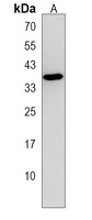 Anti-AIMP2 Antibody