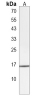 Anti-DCTPP1 Antibody