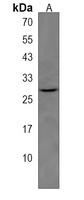 Anti-NMRK2 Antibody