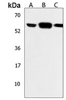 Anti-UGP2 Antibody