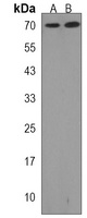 Anti-GGA1 Antibody