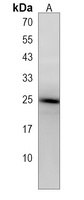 Anti-ARL2 Antibody