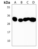 Anti-OR7C2 Antibody