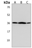 Anti-OR5V1 Antibody
