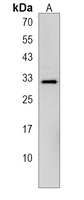 Anti-DLX1 Antibody