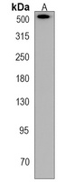 Anti-Plectin Antibody