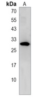 Anti-MVB12A Antibody