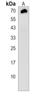 Anti-TMEM106B Antibody