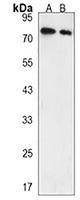Anti-CD110 Antibody