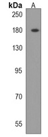 Anti-ADAMTS20 Antibody