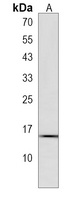 Anti-SYNJ2BP Antibody