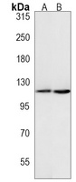 Anti-NOP2 Antibody