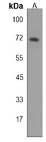 Anti-STT3A Antibody