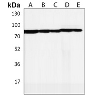 Anti-LRCH4 Antibody