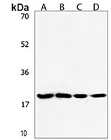Anti-ANAPC11 Antibody