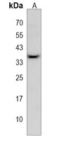 Anti-GLT6D1 Antibody