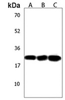 Anti-NAA40 Antibody