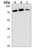 Anti-SPTLC3 Antibody