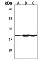 Anti-TUSC1 Antibody