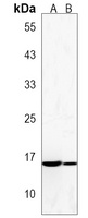 Anti-NT5C Antibody