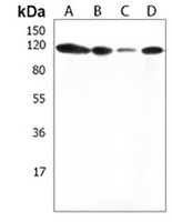 Anti-THSD1 Antibody