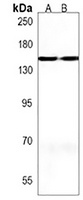 Anti-MTUS2 Antibody