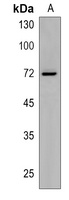 Anti-SLC6A19 Antibody