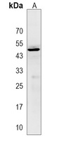 Anti-ACP6 Antibody