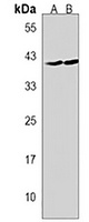 Anti-GMPPB Antibody