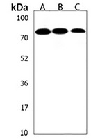 Anti-PLA2G4F Antibody