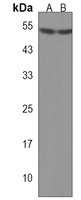 Anti-AADACL4 Antibody