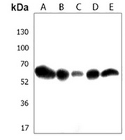 Anti-RSL1D1 Antibody