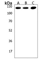 Anti-LRIG3 Antibody