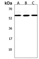 Anti-ZNF513 Antibody