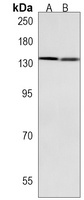 Anti-MTUS1 Antibody