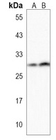 Anti-PPAPDC1B Antibody