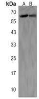 Anti-SLC5A8 Antibody