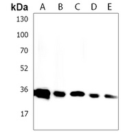 Anti-RNPS1 Antibody